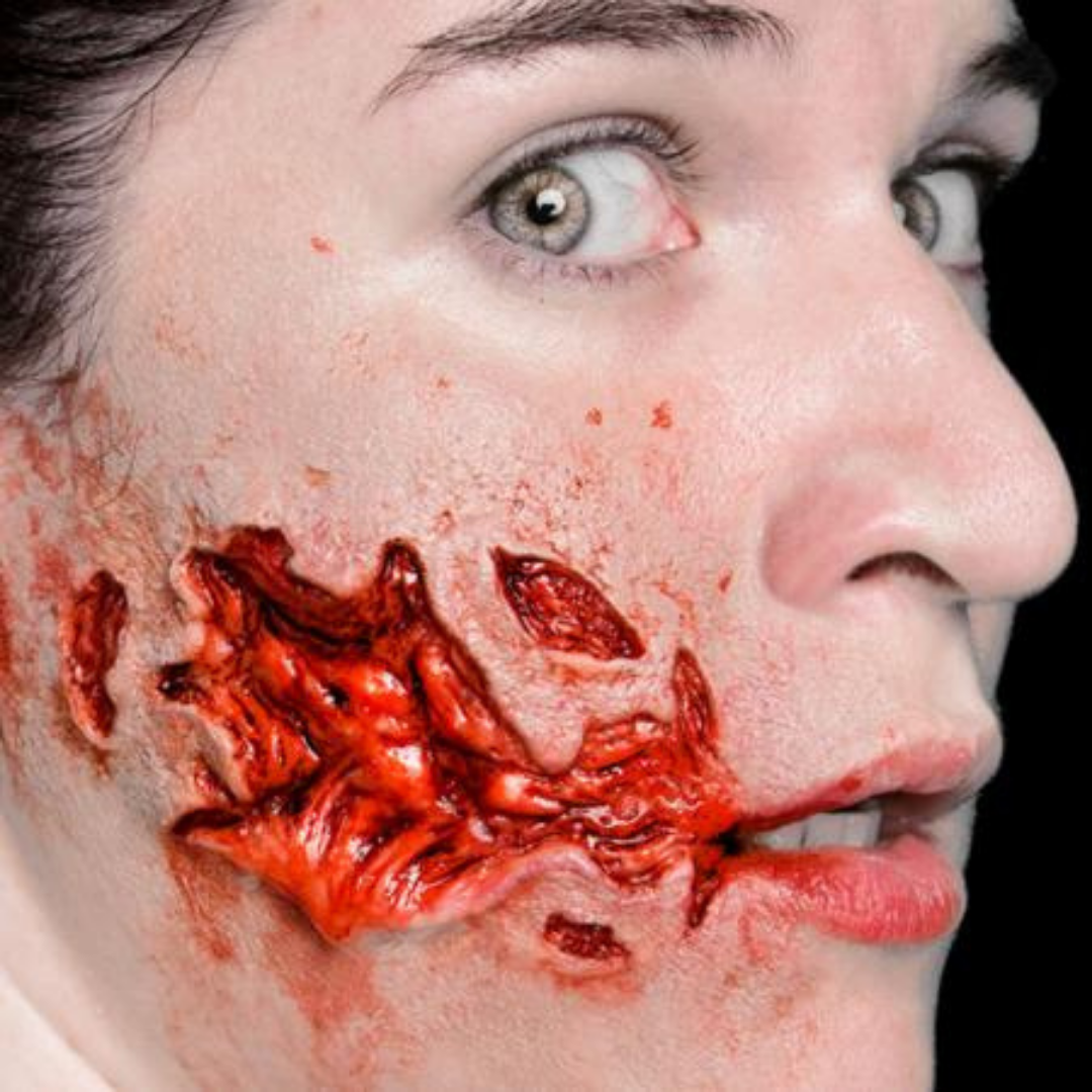 Gash