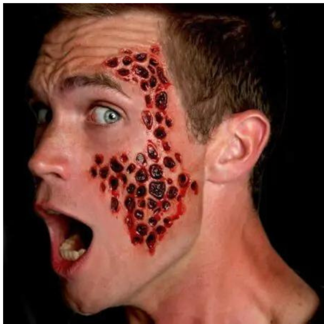 Tripophobia